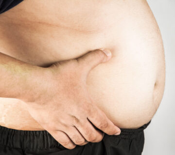 Obesidad en Europa. Dietista - nutricionistas en Pamplona. Javier Larráyoz